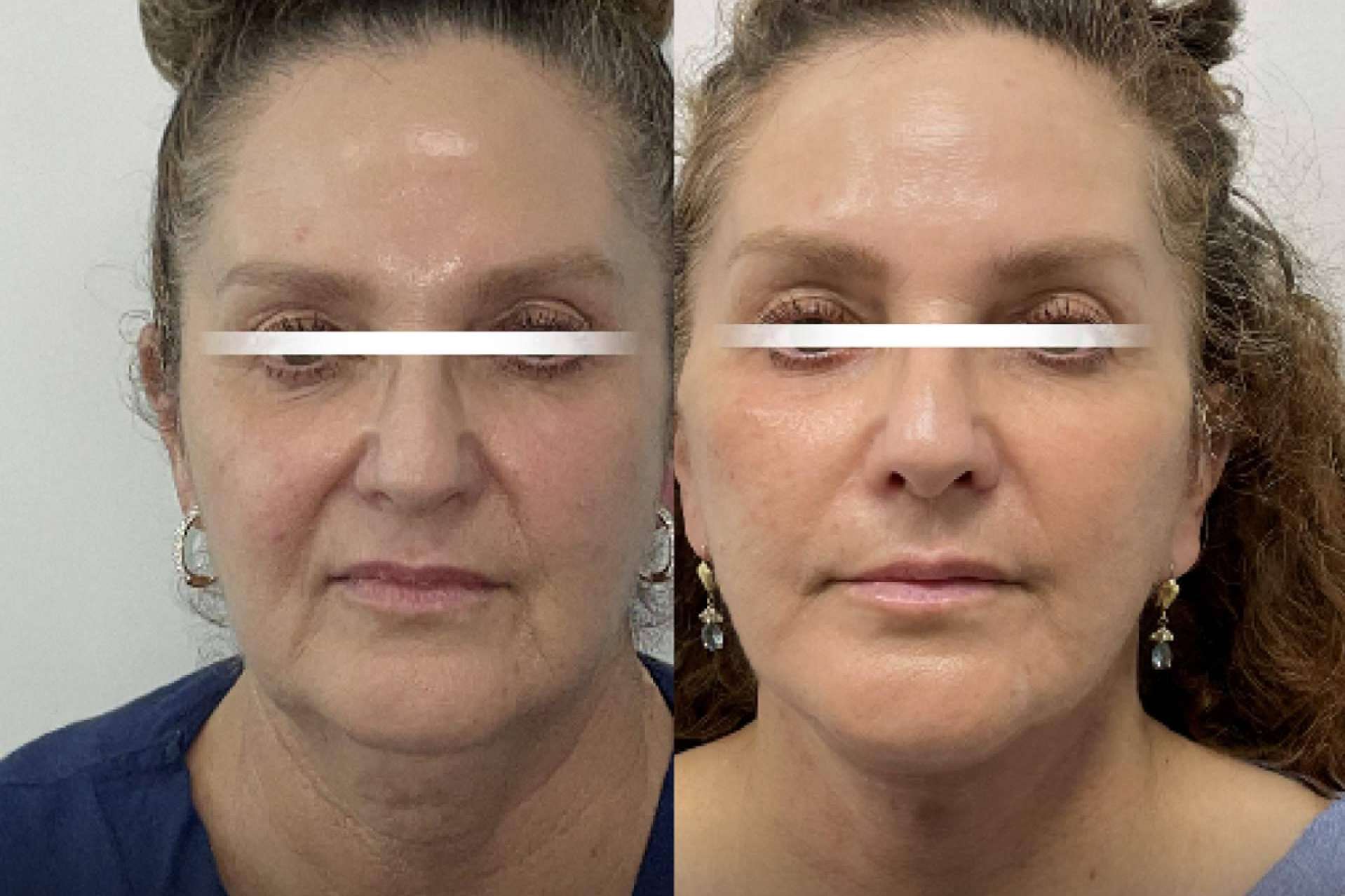 From Hollywood to Miami; Elite Plastic Surgery Is Now Closer Than Ever